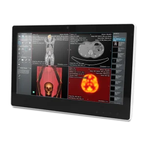 Onyx Healthcare SMA-1533 15,6″ ohut tuulettimeton paneeli-PC